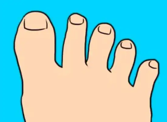 脚趾甲发白怎么办