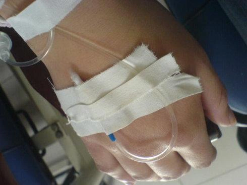 医院挂吊水,滴水的速度是根据什么来的?