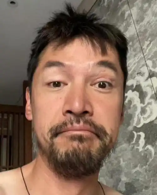 41岁胡歌伦敦开会!颜值回春变帅气,生图白发抢镜,疤痕加深