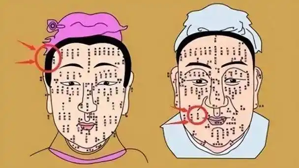 孩子这些地方的"痣",是"好福气"的寓意?