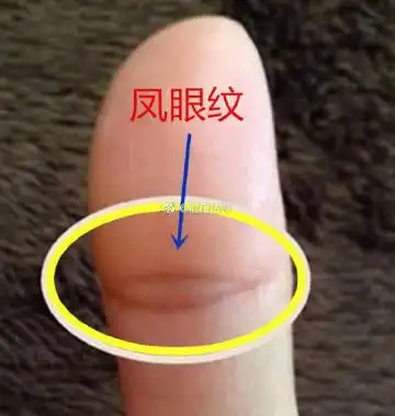 大拇指上出现凤眼纹是. - @面相法师的微博 - 微博