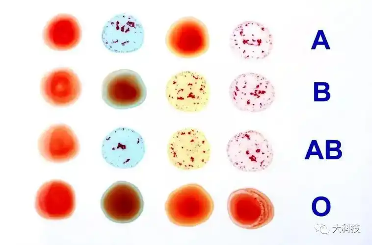 血型决定了性格?