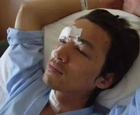 出车祸的6位明星前面五人英年早逝最后一位死里逃生险些毁容