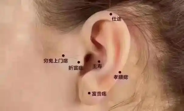 耳前有明痣,定是散金痣!投资赚钱一场空