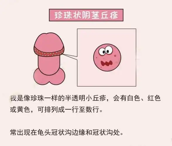 丁丁上长了小疙瘩!我是得性病了吗