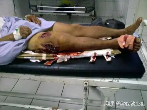 被枪打了之后是像电视里面一样只有一个孔吗?