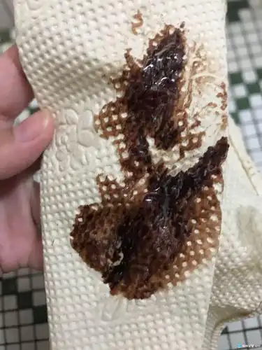 [试管婴儿]上个星期复查积液少了点,但不知