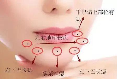 下巴有痣有什么具体含义,明易根据下巴有痣图解大全帮您解读,让您全面