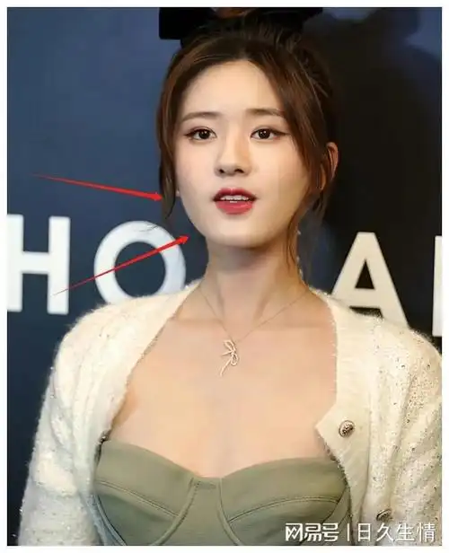 赵露思近照大变样!脸小一半,变网红"充气脸",网友:整了?