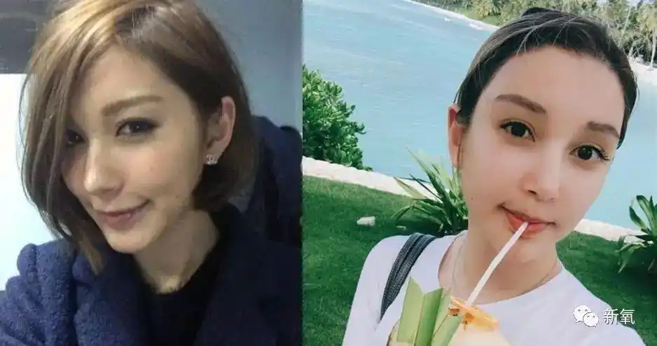 包养薛之谦并陪他去韩国做修复手术的网红,自己也是照着雪梨整的