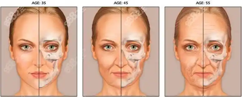 面部衰老过程示意图