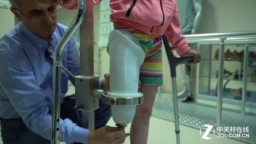 3d技术在叙利亚战场 残疾儿童终于重新站立