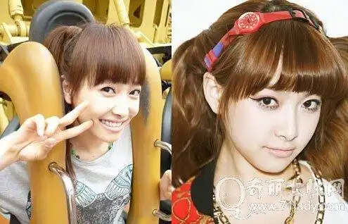 宋茜整容前后照片差别大 整容前素颜照容貌惊悚(2)