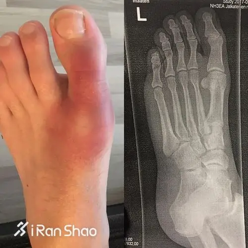 深度| 不一样的777挑战 7大洲7场超马只为7所学校募集善款