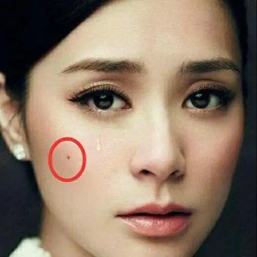 桃花痣# 桃花痣和泪痣的区别,都有什么含. 来自娱圈最帅王子 - 微博