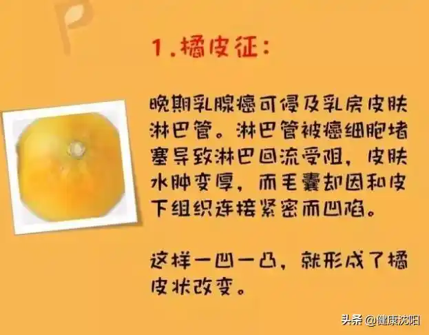 乳腺癌出现肿块很容易理解,那么静脉曲张,橘皮征,酒窝征等奇怪的征象