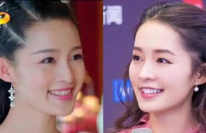 李沁牙齿变白了?《微微一笑很倾城》孟逸然整牙如换脸,颜值飙升