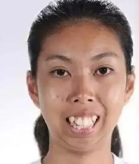 看完龅牙妹的照片后我终于相信了原来杨颖之前说的都是真的