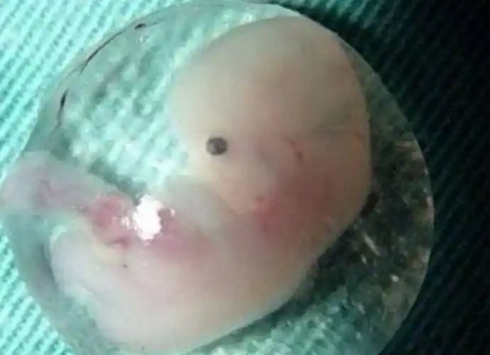 好不容易怀上孩子丈夫却逼着孕妈把胎儿打掉真相为何如此残忍