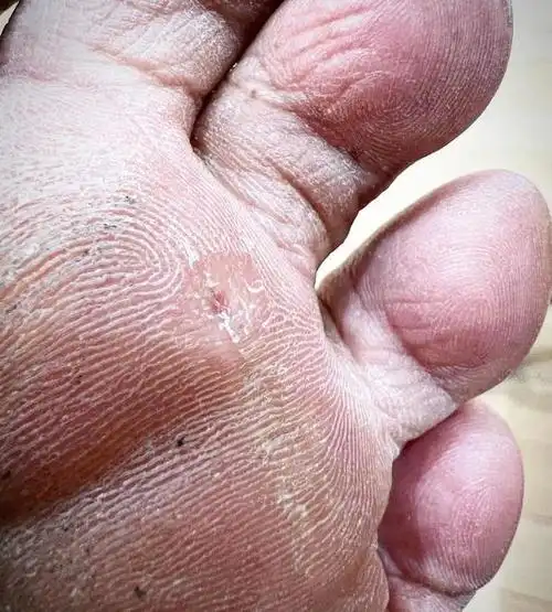 8月26日,村上隆在自己的社交媒体上晒出了一张脚底板的照片,配文说:"