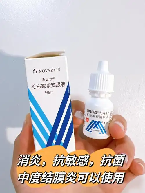 过敏性结膜炎细菌性结膜炎含泪分享