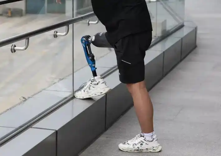 优邦假肢带你了解大腿假肢安装注意事项