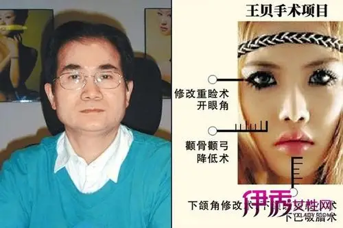 超女王贝整容致死 中国女孩的瓜子脸之路