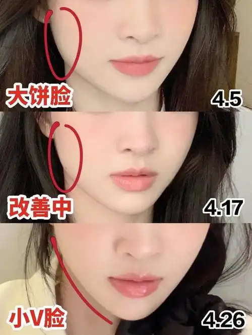 大饼脸是什么意思?