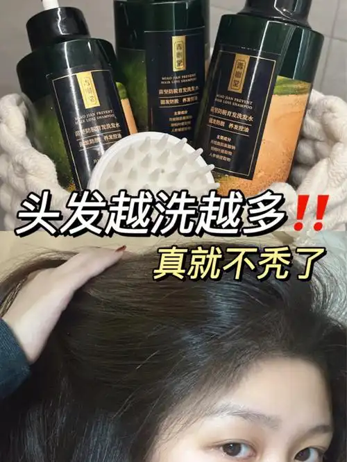 头发越洗越多防脱控油真不难