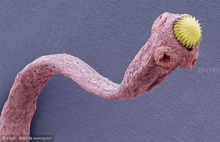 女子乳房取出13厘米活虫!这些习惯和数据跟横县人有关!