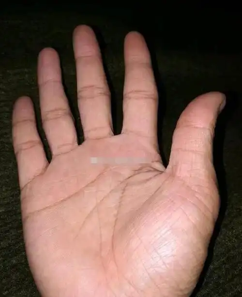 手相金星丘横纹事业操劳受婚姻影响事业发展缓慢