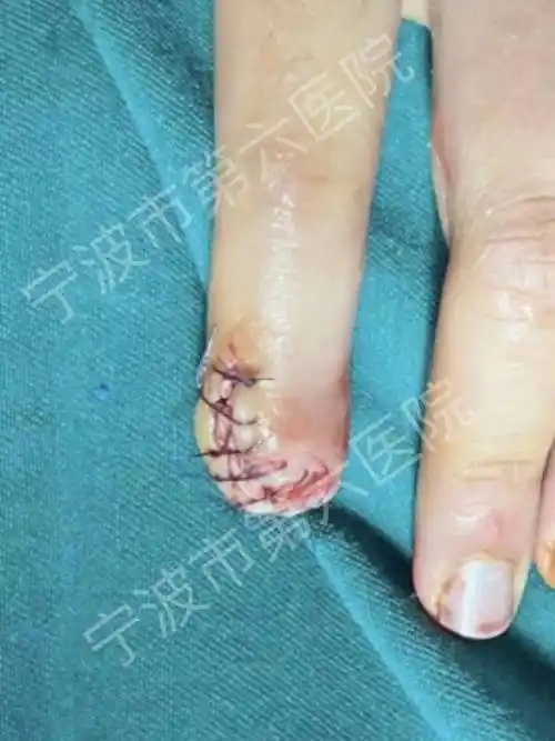 只因这个动作_指甲_手指_发展