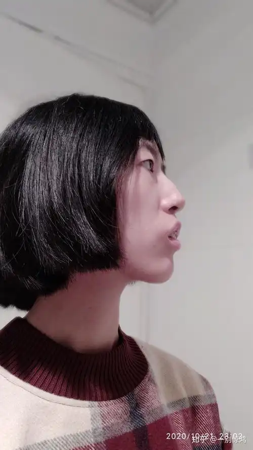 侧脸不好看怎么办?是哪里不协调或者是哪里有缺陷?