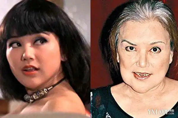 整容前后邵音音近照 昔日美貌不再老公包养小三