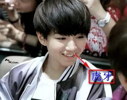 牙齿对人很重要,影响人的面相,长虎牙的人命运好吗