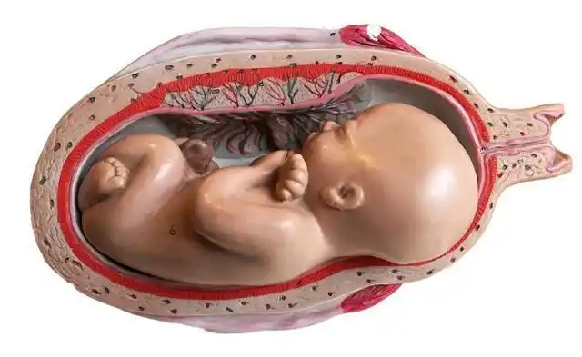 绒毛膜羊膜炎属于宫内炎症并发症比较多胎盘疾病还需尽早诊断