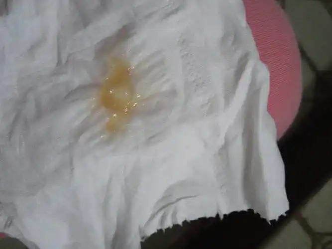 白带有一点点血色,我现在34周了,有事吗?别的没事