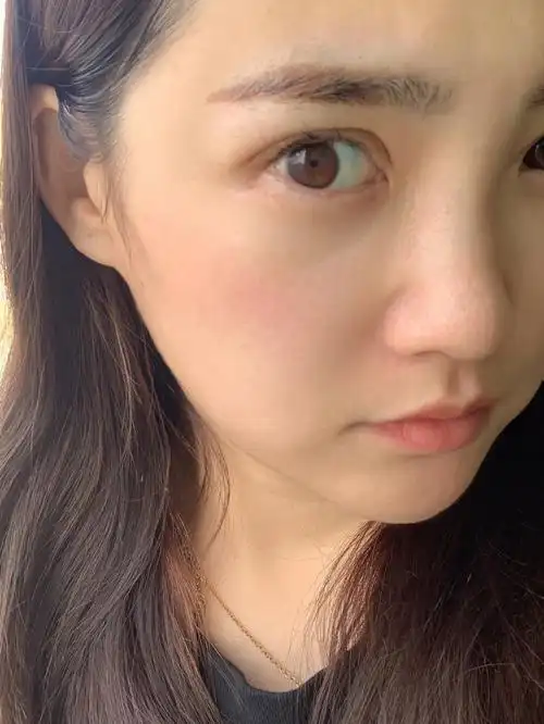 原相机下的皮肤状态