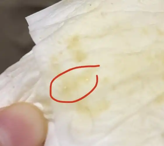 【讨论】请大家帮忙看下这是结晶吗