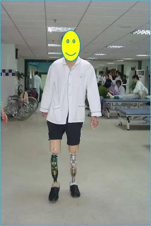 双膝截肢者