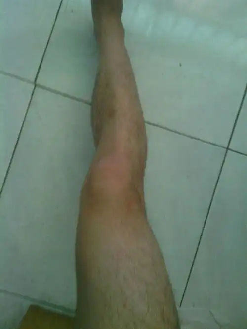 为什么我的腿关节是弯的,如图所示