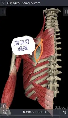 用《内针》治疗肩胛骨疼痛,肩膀疼痛