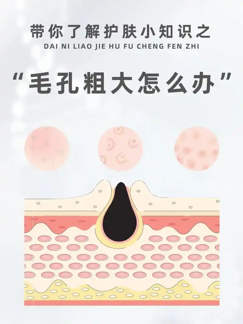 毛孔粗大怎么办?上篇提到,很多因素都会导致毛孔粗大,那么我们 - 抖音
