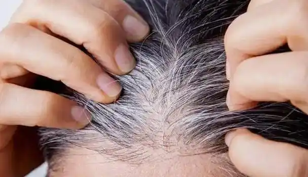 白发长在哪,病就出在哪?长在前额,后脑勺,两鬓,分别代表什么