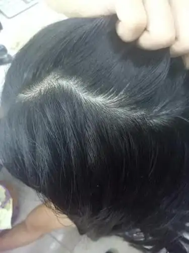 头皮颜色正常吗