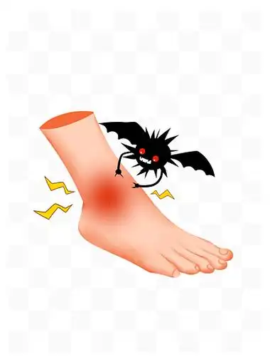 i>关 /i> i>节 /i> i>痛 /i>风脚腕 i>痛 /i>风示意图