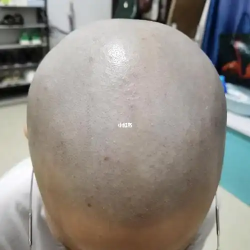 光头第13天 刮第6次_光头女生_时尚_发型