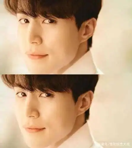 以及软组织流失带来的多层深情双眼皮.