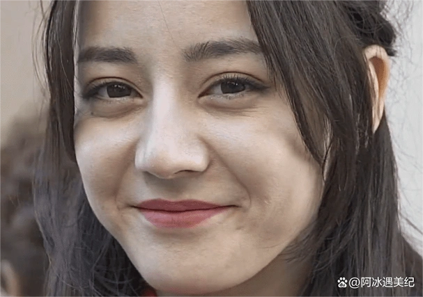 即使是万众瞩目的明星们,也逃不过岁月在脸上留下痕迹,皮肤衰老的表现