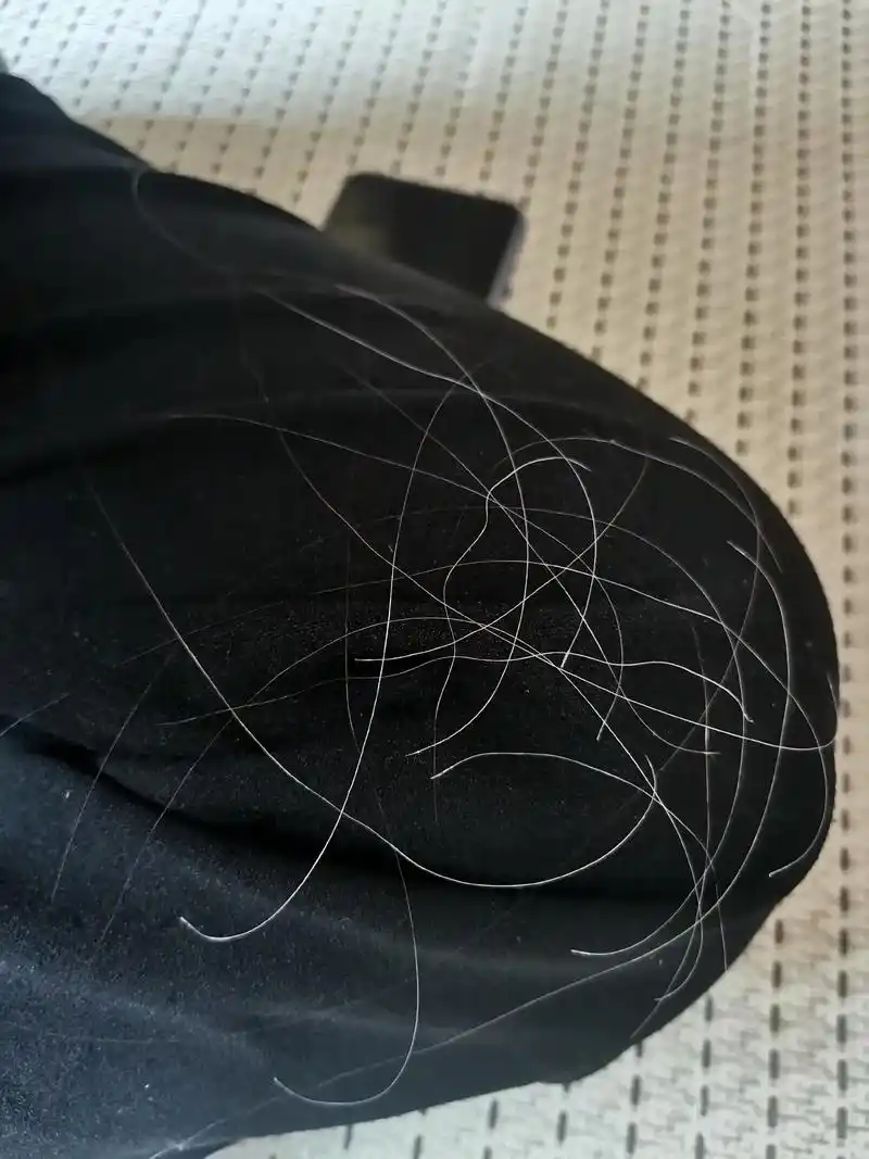 妞说妈妈有白头发了,几天之间白发呈现,活到现在就这几个月让我 - 抖